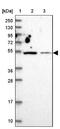 Zinc Finger Protein 322 antibody, NBP2-33384, Novus Biologicals, Western Blot image 