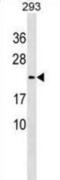 Lysozyme Like 1 antibody, abx030379, Abbexa, Western Blot image 