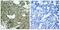 Mitogen-Activated Protein Kinase Kinase 1 antibody, A00292S222-1, Boster Biological Technology, Immunohistochemistry paraffin image 
