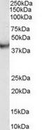 VPS37C Subunit Of ESCRT-I antibody, TA303042, Origene, Western Blot image 