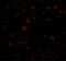 BMI1 Proto-Oncogene, Polycomb Ring Finger antibody, GTX31296, GeneTex, Immunocytochemistry image 