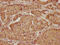 Keratin 20 antibody, CSB-PA012536LA01HU, Cusabio, Immunohistochemistry paraffin image 
