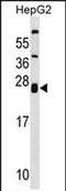 Zinc And Ring Finger 1 antibody, PA5-71962, Invitrogen Antibodies, Western Blot image 