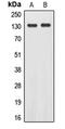 EPH Receptor A2 antibody, LS-C352153, Lifespan Biosciences, Western Blot image 