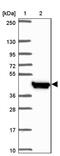 Iroquois Homeobox 2 antibody, PA5-63000, Invitrogen Antibodies, Western Blot image 