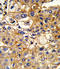 Major Histocompatibility Complex, Class I, B antibody, LS-C164912, Lifespan Biosciences, Immunohistochemistry paraffin image 
