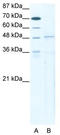 T-Box 5 antibody, TA334175, Origene, Western Blot image 