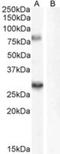 Synaptic vesicle glycoprotein 2A antibody, NB100-41402, Novus Biologicals, Western Blot image 