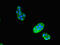 Vacuolar protein sorting-associated protein 29 antibody, CSB-PA890661LA01HU, Cusabio, Immunofluorescence image 