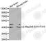 Mitogen-Activated Protein Kinase Kinase 5 antibody, AP0392, ABclonal Technology, Western Blot image 