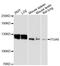 Integrin Subunit Alpha 8 antibody, LS-C748121, Lifespan Biosciences, Western Blot image 