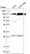 Chromosome Transmission Fidelity Factor 18 antibody, NBP2-58935, Novus Biologicals, Western Blot image 
