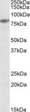 Lymphocyte Cytosolic Protein 2 antibody, GTX17029, GeneTex, Western Blot image 