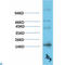 Transthyretin antibody, LS-C813256, Lifespan Biosciences, Western Blot image 