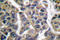 MAGE Family Member A1 antibody, LS-C176108, Lifespan Biosciences, Immunohistochemistry paraffin image 