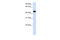 Makorin Ring Finger Protein 2 antibody, 25-827, ProSci, Western Blot image 