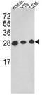 TPI antibody, AP17803PU-N, Origene, Western Blot image 