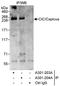 Capicua Transcriptional Repressor antibody, A301-203A, Bethyl Labs, Immunoprecipitation image 