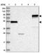 Actin Binding LIM Protein 1 antibody, PA5-58607, Invitrogen Antibodies, Western Blot image 