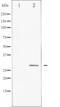 Heat Shock Protein Family B (Small) Member 1 antibody, abx010950, Abbexa, Western Blot image 