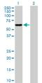 Isocitrate Dehydrogenase (NAD(+)) 3 Beta antibody, H00003420-D01P, Novus Biologicals, Western Blot image 