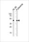 Myogenic Differentiation 1 antibody, LS-B9421, Lifespan Biosciences, Western Blot image 