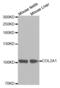 Collagen Type II Alpha 1 Chain antibody, abx001311, Abbexa, Western Blot image 