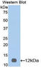 Interleukin 12 Receptor Subunit Beta 2 antibody, LS-C294828, Lifespan Biosciences, Western Blot image 