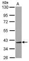 Aminoacyl TRNA Synthetase Complex Interacting Multifunctional Protein 2 antibody, PA5-31239, Invitrogen Antibodies, Western Blot image 