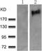 ABL Proto-Oncogene 1, Non-Receptor Tyrosine Kinase antibody, TA322664, Origene, Western Blot image 