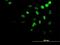 Homeobox A11 antibody, H00003207-M08, Novus Biologicals, Immunofluorescence image 