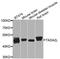 Transcriptional Adaptor 2A antibody, STJ110755, St John