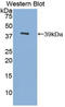 Metallothionein 3 antibody, LS-C295360, Lifespan Biosciences, Western Blot image 