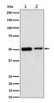Annexin A7 antibody, M04889-1, Boster Biological Technology, Western Blot image 
