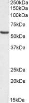 Suppressor Of Cytokine Signaling 7 antibody, 46-764, ProSci, Western Blot image 