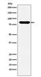 Solute Carrier Family 3 Member 2 antibody, M01794, Boster Biological Technology, Western Blot image 