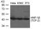 HNF1 Homeobox B antibody, GTX50838, GeneTex, Western Blot image 