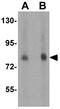 Fas Associated Factor 1 antibody, GTX31302, GeneTex, Western Blot image 