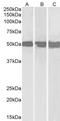 DEAD-Box Helicase 6 antibody, TA302462, Origene, Western Blot image 