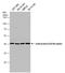 Adenosine A2b Receptor antibody, GTX132217, GeneTex, Western Blot image 