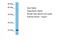 RAB5B, Member RAS Oncogene Family antibody, ARP56499_P050, Aviva Systems Biology, Western Blot image 