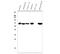DEAD-Box Helicase 5 antibody, M00670-1, Boster Biological Technology, Western Blot image 