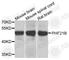 PHD Finger Protein 21B antibody, A7849, ABclonal Technology, Western Blot image 