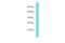 Chromosome 10 Open Reading Frame 25 antibody, A17877, Boster Biological Technology, Western Blot image 