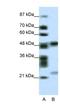 PHD Finger Protein 11 antibody, NBP1-80054, Novus Biologicals, Western Blot image 