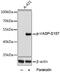 Vasodilator Stimulated Phosphoprotein antibody, GTX66601, GeneTex, Western Blot image 