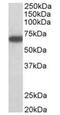 Glutamate Decarboxylase 1 antibody, orb125196, Biorbyt, Western Blot image 
