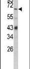 Complement Factor B antibody, PA5-26047, Invitrogen Antibodies, Western Blot image 