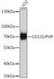 PVR Cell Adhesion Molecule antibody, GTX32498, GeneTex, Western Blot image 
