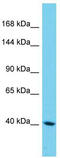 Sterile Alpha Motif Domain Containing 9 Like antibody, TA333477, Origene, Western Blot image 